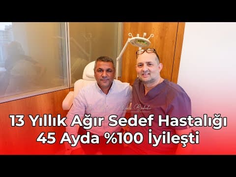 13 Yıllık Ağır Sedef Hastalığında 45 Aylık Tedavi Süreci